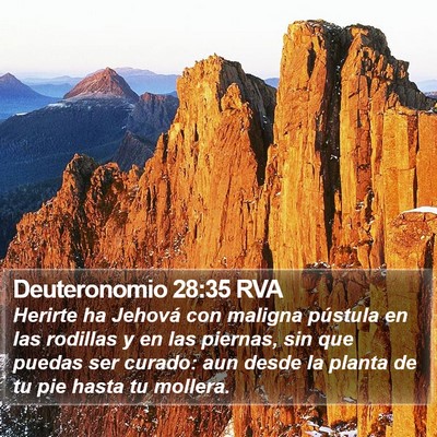 Deuteronomio 28:35 RVA Bible Verse Image