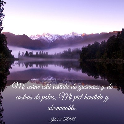 Picture 03 - Job 7:5 RVA - Mi carne está vestida de gusanos, y de costras - Bible Verse Picture