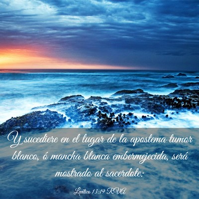 Picture 03 - Levítico 13:19 RVA - Y sucediere en el lugar de la apostema tumor - Bible Verse Picture