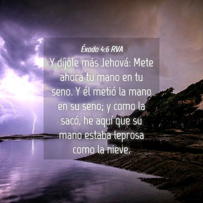 Picture 04 - Éxodo 4:6 RVA - Y díjole más Jehová: Mete ahora tu mano en tu - Bible Verse Picture